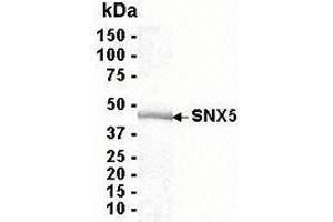 Western Blotting (WB) image for Sorting Nexin 5 (SNX5) (AA 1-404) protein (ABIN2469078) (SNX5 Protein (AA 1-404))