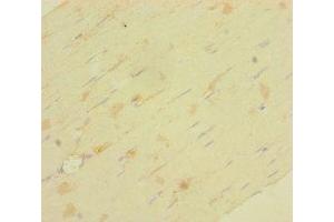 Immunohistochemistry of paraffin-embedded human skeletal muscle tissue using ABIN7158146 at dilution of 1:100 (LRRC19 抗体  (AA 25-270))