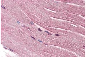Human Skeletal Muscle (formalin-fixed, paraffin-embedded) stained with SH3GLB1 antibody ABIN334268 at 2. (SH3GLB1 抗体)