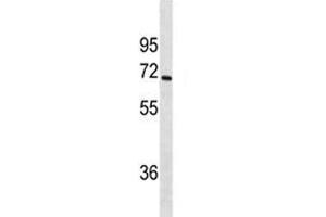 Western Blotting (WB) image for anti-Cytochrome P450, Family 1, Subfamily A, Polypeptide 2 (CYP1A2) (AA 255-282) antibody (ABIN3030675)