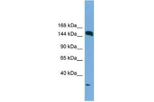 WB Suggested Anti-EEA1 Antibody Titration: 0. (EEA1 抗体  (N-Term))