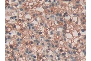 Immunohistochemistry (IHC) image for anti-Sprouty Homolog 3 (SPRY3) (AA 91-288) antibody (ABIN7439759)