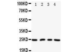 Anti-NPM2 antibody, Western blotting Lane 1: HELA Cell Lysate Lane 2: U87 Cell Lysate Lane 3: A549 Cell Lysate Lane 4: SMMC Cell Lysate