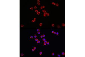 Immunofluorescence analysis of Neuro-2a cells using TrkB Rabbit pAb (ABIN3022911, ABIN3022912, ABIN3022913 and ABIN6219292) at dilution of 1:150 (40x lens). (TRKB 抗体  (AA 32-282))