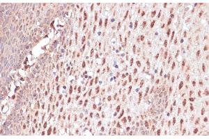 Immunohistochemistry (Paraffin-embedded Sections) (IHC (p)) image for anti-RAD50 Homolog (S. Cerevisiae) (RAD50) antibody (ABIN7010313)