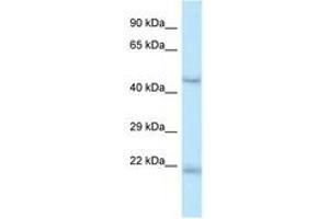 Image no. 1 for anti-One Cut Homeobox 1 (ONECUT1) (AA 370-419) antibody (ABIN6747414) (ONECUT1 抗体  (AA 370-419))