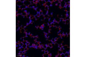 Immunofluorescence of paraffin embedded mouse lung using MRP1 (ABIN7074544) at dilution of 1:1000 (250x lens) (Multidrug-Resistance Like Protein 1 抗体)