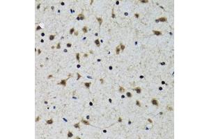 Immunohistochemistry of paraffin-embedded rat brain using SLC23A2 antibody (ABIN5974077) at dilution of 1/100 (40x lens). (SLC23A2 抗体)