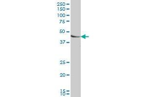 SMAD7 monoclonal antibody (M06), clone 4E1 Western Blot analysis of SMAD7 expression in HeLa . (SMAD7 抗体  (AA 160-260))