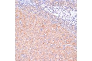 Immunohistochemistry of paraffin-embedded rat ovary using K antibody (ABIN7268147) at dilution of 1:100 (40x lens). (KANK2 抗体  (AA 1-300))