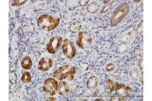 Immunoperoxidase of monoclonal antibody to TLN1 on formalin-fixed paraffin-embedded human stomach. (TLN1 抗体  (AA 1052-1149))