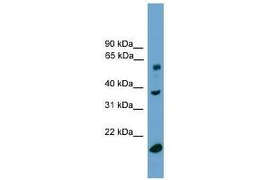 TBL1Y antibody used at 0. (TBL1Y 抗体  (Middle Region))
