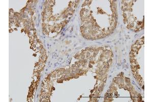 Immunostaining (ISt) image for anti-Tubulin, Alpha, 3C (TUBA3C) (AA 1-418) antibody (ABIN563291)