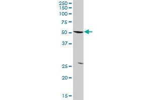 PFKFB3 MaxPab rabbit polyclonal antibody. (PFKFB3 抗体  (AA 1-520))