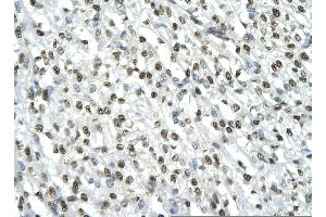 Immunohistochemistry (IHC) image for anti-High Mobility Group Box 2 (HMGB2) (C-Term) antibody (ABIN2777510)