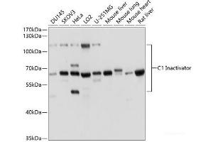 Western blot analysis of extracts of various cell lines using C1 Inactivator Polyclonal Antibody at dilution of 1:1000.