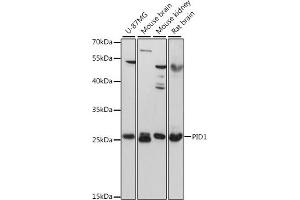Western blot analysis of extracts of various cell lines, using PID1 antibody (ABIN6133302, ABIN6145610, ABIN6145611 and ABIN6217139) at 1:3000 dilution. (PID1 抗体  (AA 124-248))