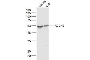 Lane 1: U87mg Cell lysates Lane 2: BV2 Cell lysates probed with ACCN2 Polyclonal Antibody, unconjugated  at 1:300 overnight at 4°C followed by a conjugated secondary antibody for 60 minutes at 37°C. (ASIC1 抗体  (AA 332-460))