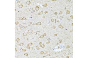 Immunohistochemistry of paraffin-embedded rat brain using FDPS Antibody. (FDPS 抗体  (AA 120-419))