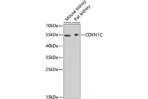 Western blot analysis of extracts of various cell lines using CDKN1C Polyclonal Antibody at dilution of 1:1000. (CDKN1C 抗体)
