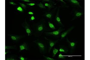 Immunofluorescence (IF) image for anti-Protein Phosphatase 1, Catalytic Subunit, gamma Isoform (PPP1CC) (AA 1-323) antibody (ABIN948300)
