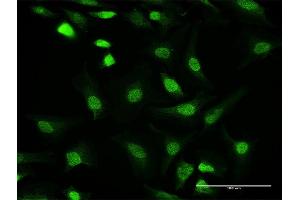 Immunofluorescence of purified MaxPab antibody to PPP1CC on HeLa cell.