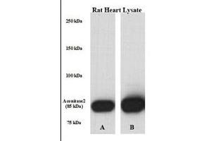 Perfused isolated rat heart whole tissue lysate was lysed with either A) 50 mM Tris-HCl, 150 mM NaCl, 1 mM EDTA, 1 % NP-40, 0. (ACO2 抗体  (AA 438-467))