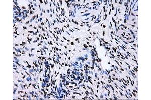 Immunohistochemical staining of paraffin-embedded Ovary tissue using anti-RALBP1mouse monoclonal antibody. (RALBP1 抗体)