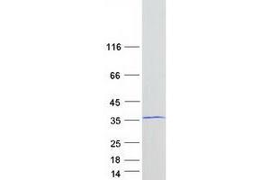 Western Blotting (WB) image for Four and A Half LIM Domains 1 (FHL1) (Transcript Variant 3) protein (Myc-DYKDDDDK Tag) (ABIN2721136)