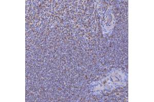 IHC analysis of CD74 using anti-CD74 antibody (ABIN7602385).