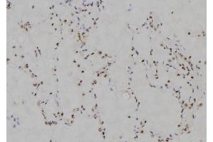 ABIN6274221 at 1/100 staining Human lung tissue by IHC-P. (MZF1 抗体  (N-Term))