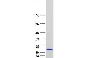Western Blotting (WB) image for DnaJ (Hsp40) Homolog, Subfamily B, Member 3 (DNAJB3) protein (Myc-DYKDDDDK Tag) (ABIN2719592)
