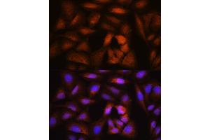 Immunofluorescence analysis of U2OS cells using NCAPH Rabbit pAb (ABIN1680979, ABIN3019036, ABIN3019037 and ABIN6220682) at dilution of 1:100. (NCAPH 抗体  (AA 1-250))