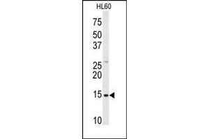 Image no. 1 for anti-SnRNP-D1 / Sm-D (Middle Region) antibody (ABIN358018) (SnRNP-D1 / Sm-D (Middle Region) 抗体)