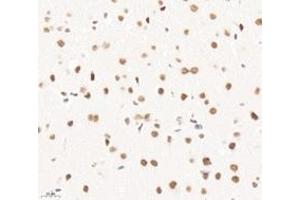 Immunohistochemistry analysis of paraffin-embedded mouse brain using,PQBP1 (ABIN7075126) at dilution of 1: 6000 (PQBP1 抗体)