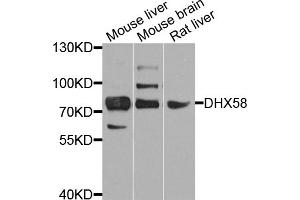 Western blot analysis of extracts of various cell lines, using DHX58 antibody (ABIN5974537) at 1/1000 dilution. (DHX58 抗体)