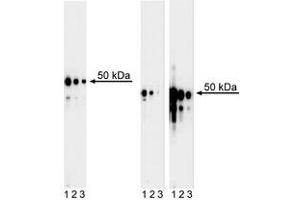 Western Blotting (WB) image for anti-GATA Binding Protein 3 (GATA3) antibody (ABIN967621) (GATA3 抗体)