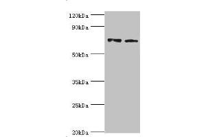 Western blot All lanes: Annexin A6 antibody at 4 μg/mL Lane 1: Jurkat whole cell lysate Lane 2: Hela whole cell lysate Secondary Goat polyclonal to rabbit IgG at 1/10000 dilution Predicted band size: 76, 73 kDa Observed band size: 76 kDa (ANXA6 抗体  (AA 1-250))