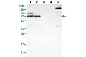 Western blot analysis of Lane 1: RT-4, Lane 2: U-251 MG, Lane 3: Human Plasma, Lane 4: Liver, Lane 5: Tonsil with METTL16 polyclonal antibody  at 1:250-1:500 dilution.