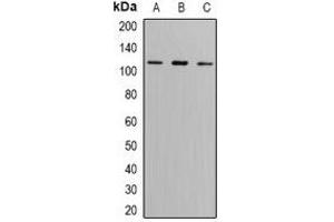 Western blot analysis of GLUR6 expression in SW620 (A), A549 (B), mouse brain (C) whole cell lysates. (GRIK2 抗体)