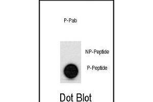 Dot blot analysis of anti-hp53- Phospho-specific Pab (ABIN389620 and ABIN2839624) on nitrocellulose membrane. (p53 抗体  (pSer315))