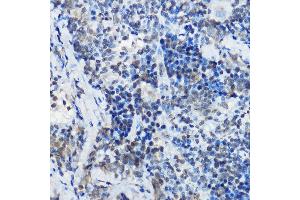 Immunohistochemistry of paraffin-embedded rat spleen using MYBBP1A Rabbit pAb (ABIN1680938, ABIN3018915, ABIN3018916 and ABIN6220628) at dilution of 1:100 (40x lens). (MYBBP1A 抗体  (AA 1104-1328))