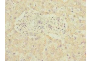 Immunohistochemistry of paraffin-embedded human liver tissue using ABIN7143403 at dilution of 1:100 (ADGRG6 (AA 40-300) 抗体)