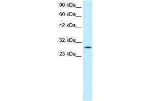 WB Suggested Anti-RGS16 Antibody Titration:  1. (RGS16 抗体  (C-Term))