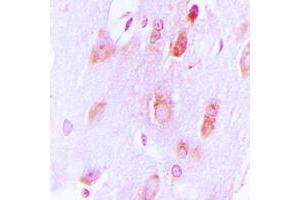 Immunohistochemical analysis of Tyrosine Hydroxylase staining in human brain formalin fixed paraffin embedded tissue section. (Tyrosine Hydroxylase 抗体  (N-Term))