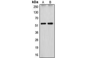 Western blot analysis of Cytochrome P450 26A1 expression in HepG2 (A), HEK293T (B) whole cell lysates.