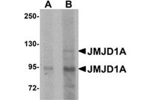 Western Blotting (WB) image for anti-Lysine (K)-Specific Demethylase 3A (KDM3A) (N-Term) antibody (ABIN1031423) (KDM3A 抗体  (N-Term))