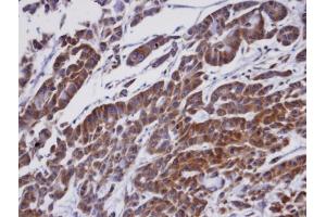 IHC-P Image Immunohistochemical analysis of paraffin-embedded A549 xenograft, using ORP1, antibody at 1:100 dilution. (OSBPL1A 抗体  (C-Term))