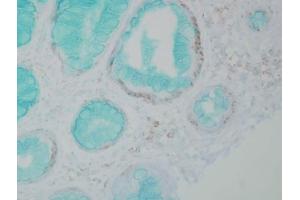 Immunohistochemistry analysis using Mouse Anti-DNMT1 Monoclonal Antibody, Clone 60B1220. (DNMT1 抗体  (AA 637-650) (HRP))