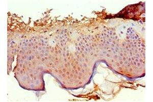 Immunohistochemistry of paraffin-embedded human skin tissue using ABIN7167500 at dilution of 1:100 (PTPRA 抗体  (AA 20-142))